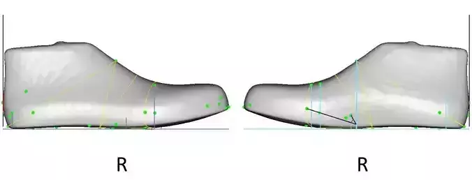 Diabetes Men Shoe  Last