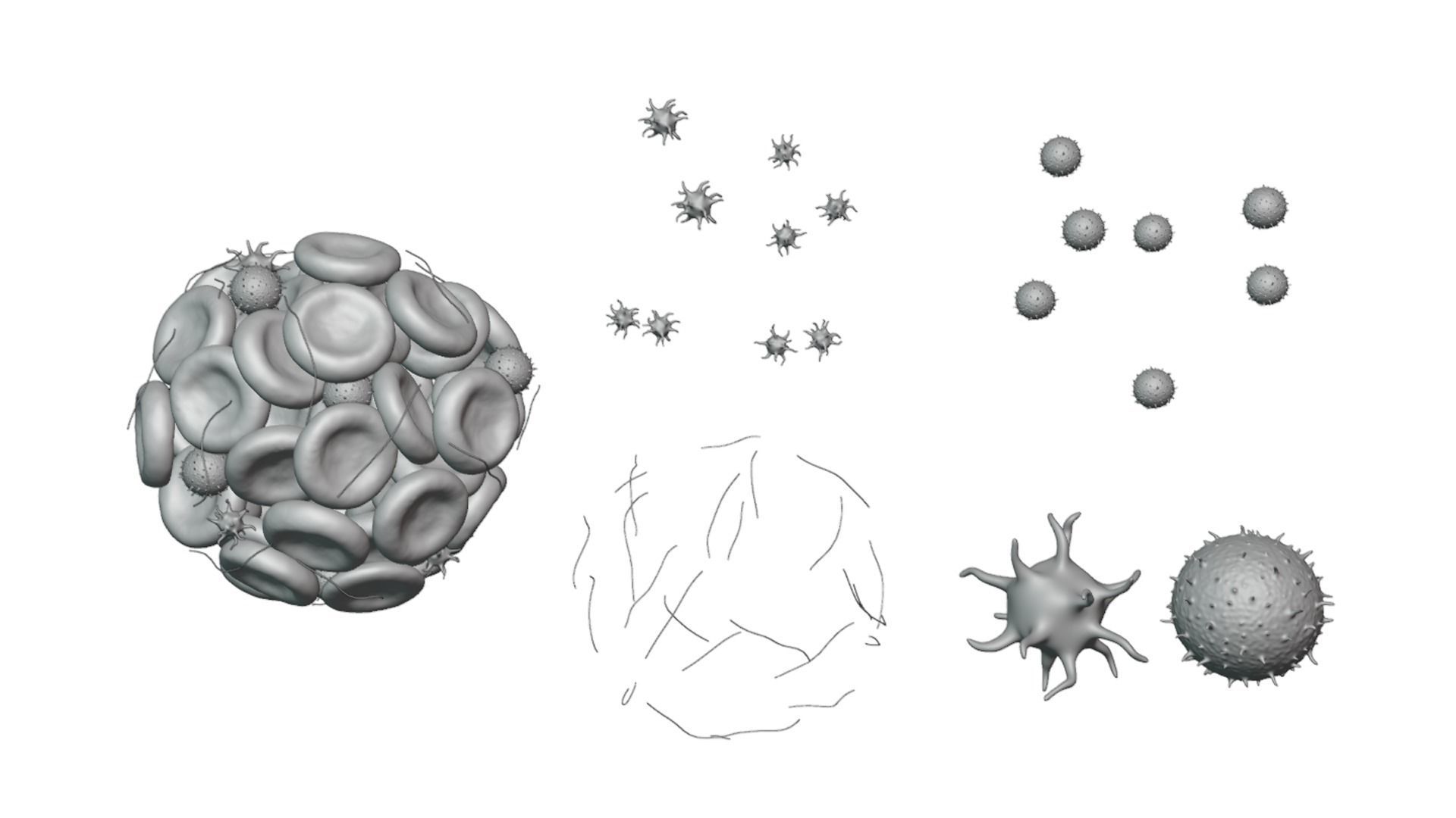 Blood Clot Thrombus 3D model_5