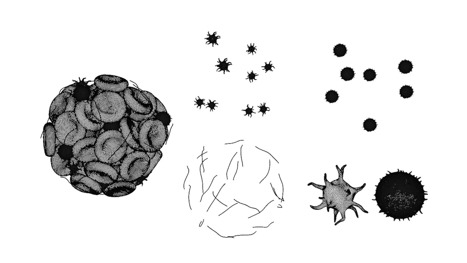 Blood Clot Thrombus 3D model_6