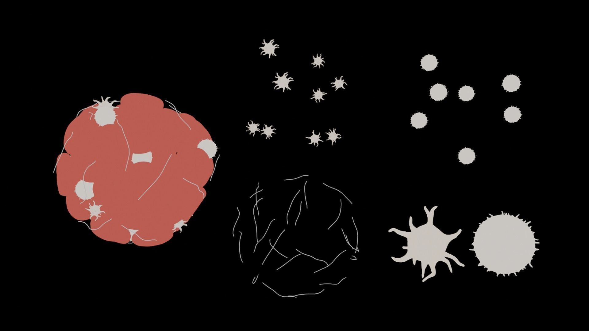 Blood Clot Thrombus 3D model_4