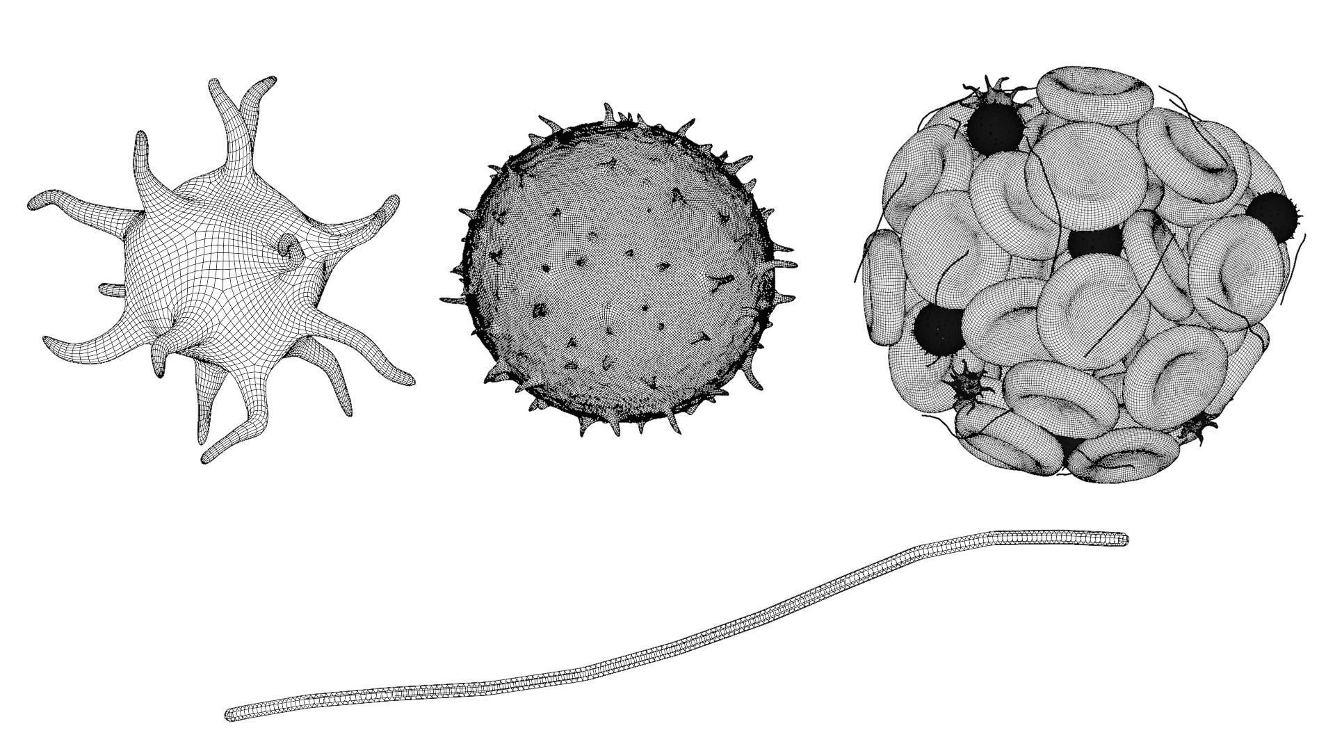Blood Clot Thrombus 3D model_7