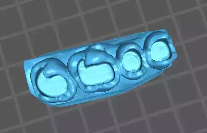 teeth models for restoration class 1