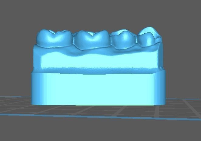 teeth model for restoration class 1 3D model 3D printable | CGTrader
