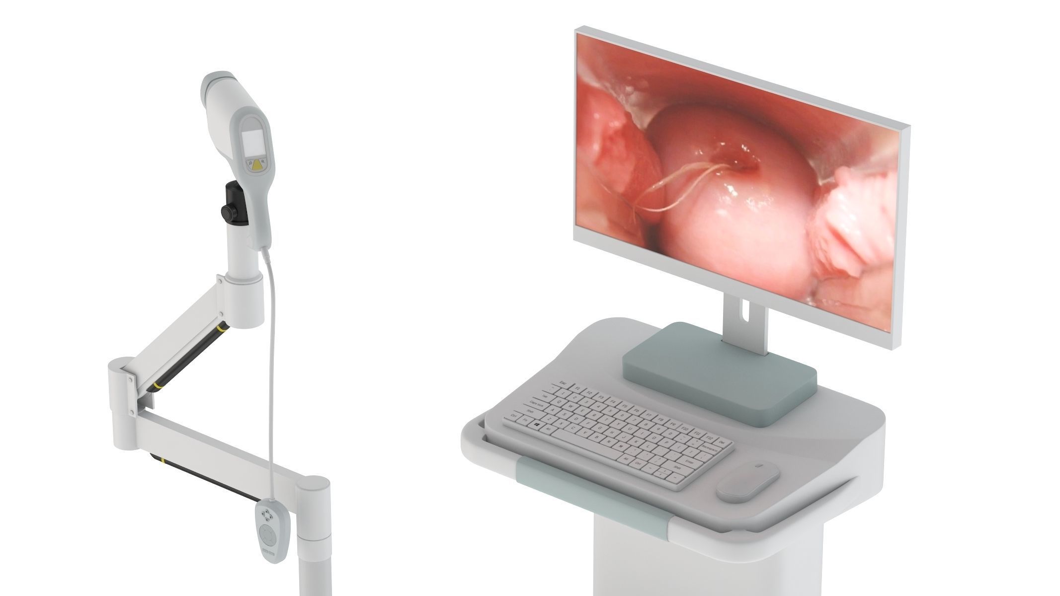 Medical Colposcopes PBR Realistic 3D model_6