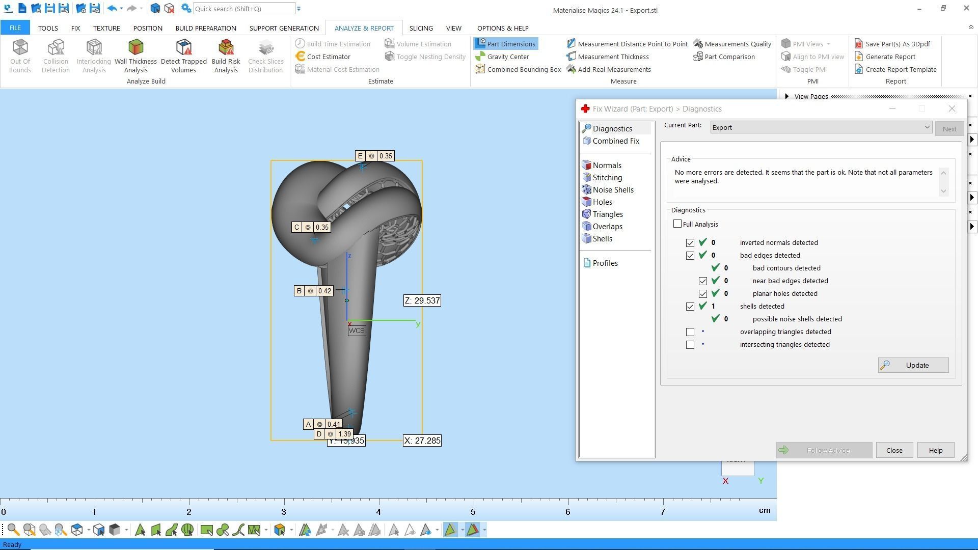 2 chain rings 3D print model_11