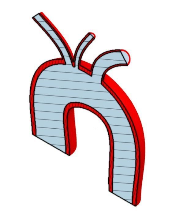3D model of Aortic Arch Real Dimensions 3D print model_6