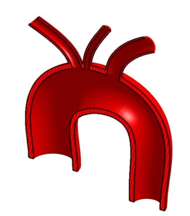 3D model of Aortic Arch Real Dimensions 3D print model_13