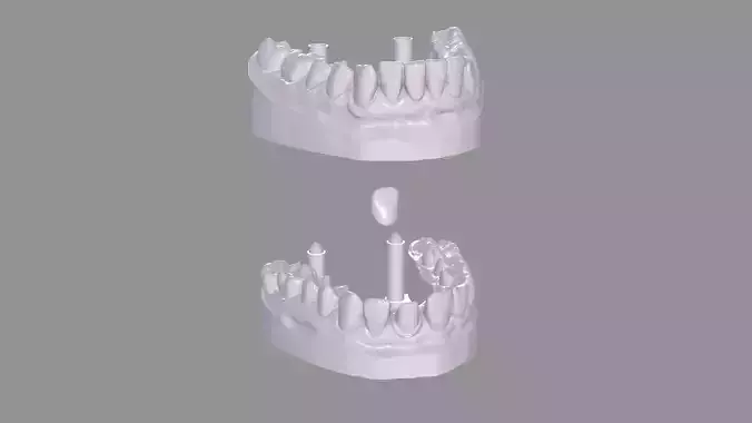 Dental printable realistic jawbones and a tooth  3D print model