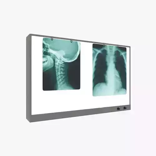 X-ray film viewer