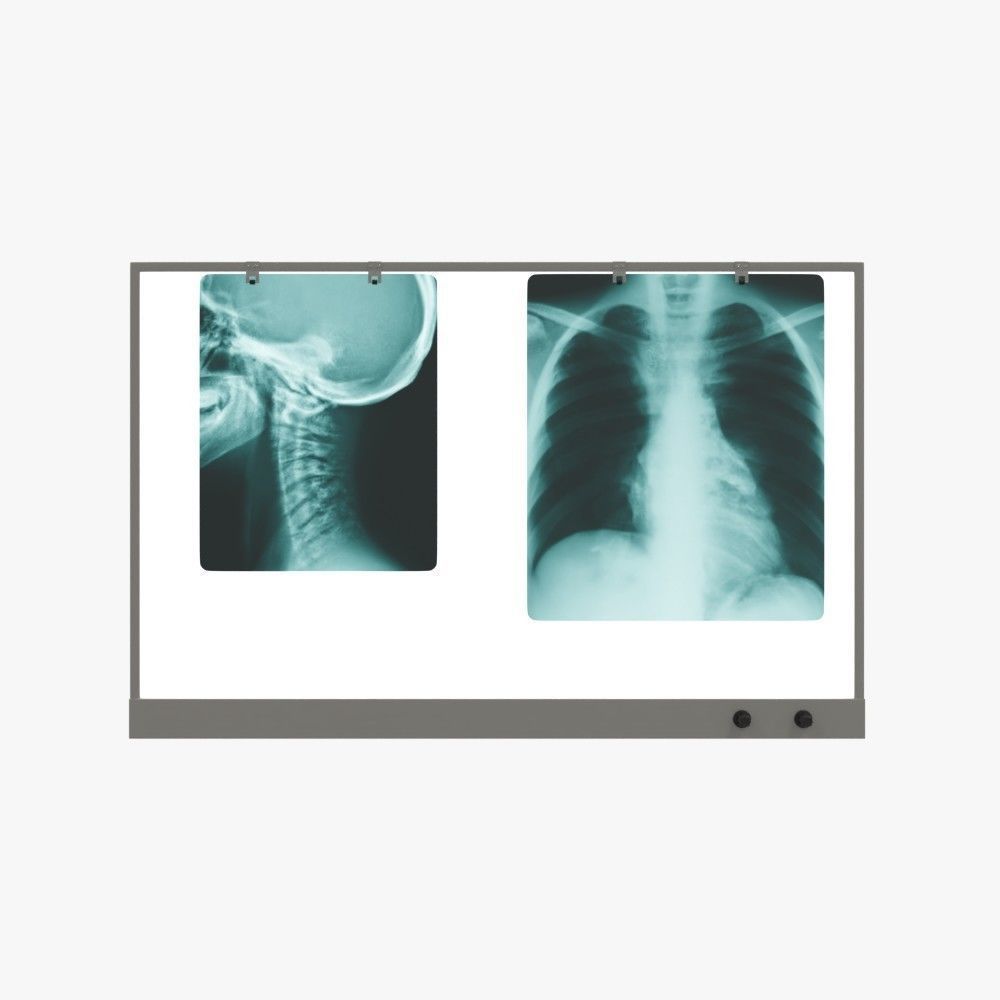 X-ray film viewer 3D model_1