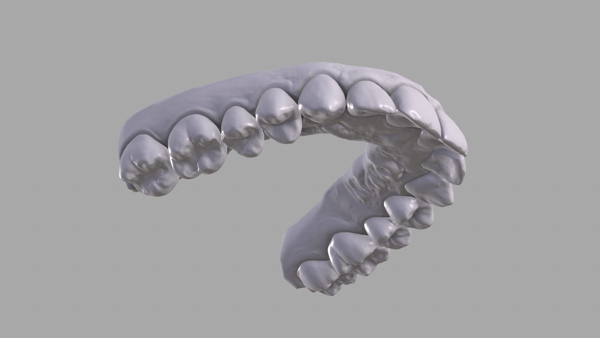 Dental upper jaw 3D scanned mouth with separated teeth  3D print model_2