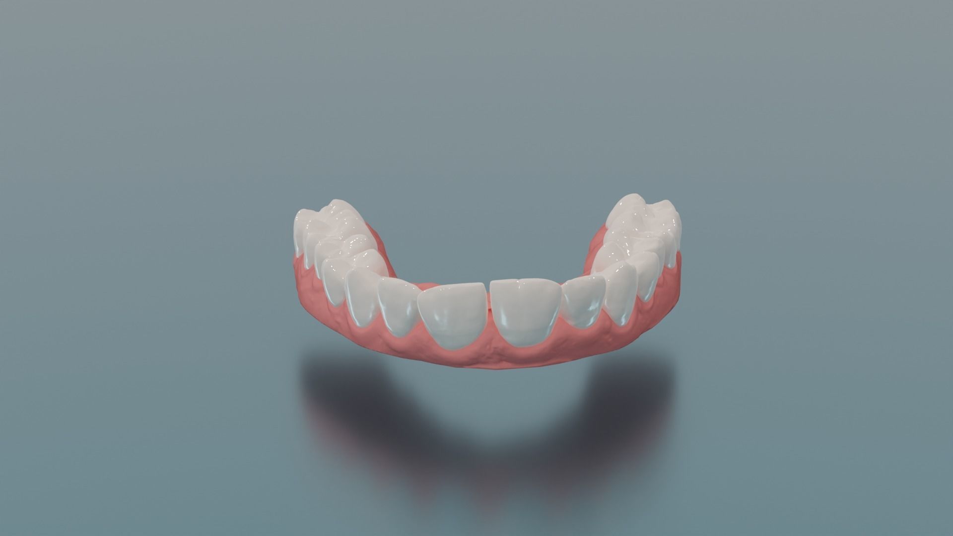 Dental upper jaw 3D scanned mouth with separated teeth  3D print model_10