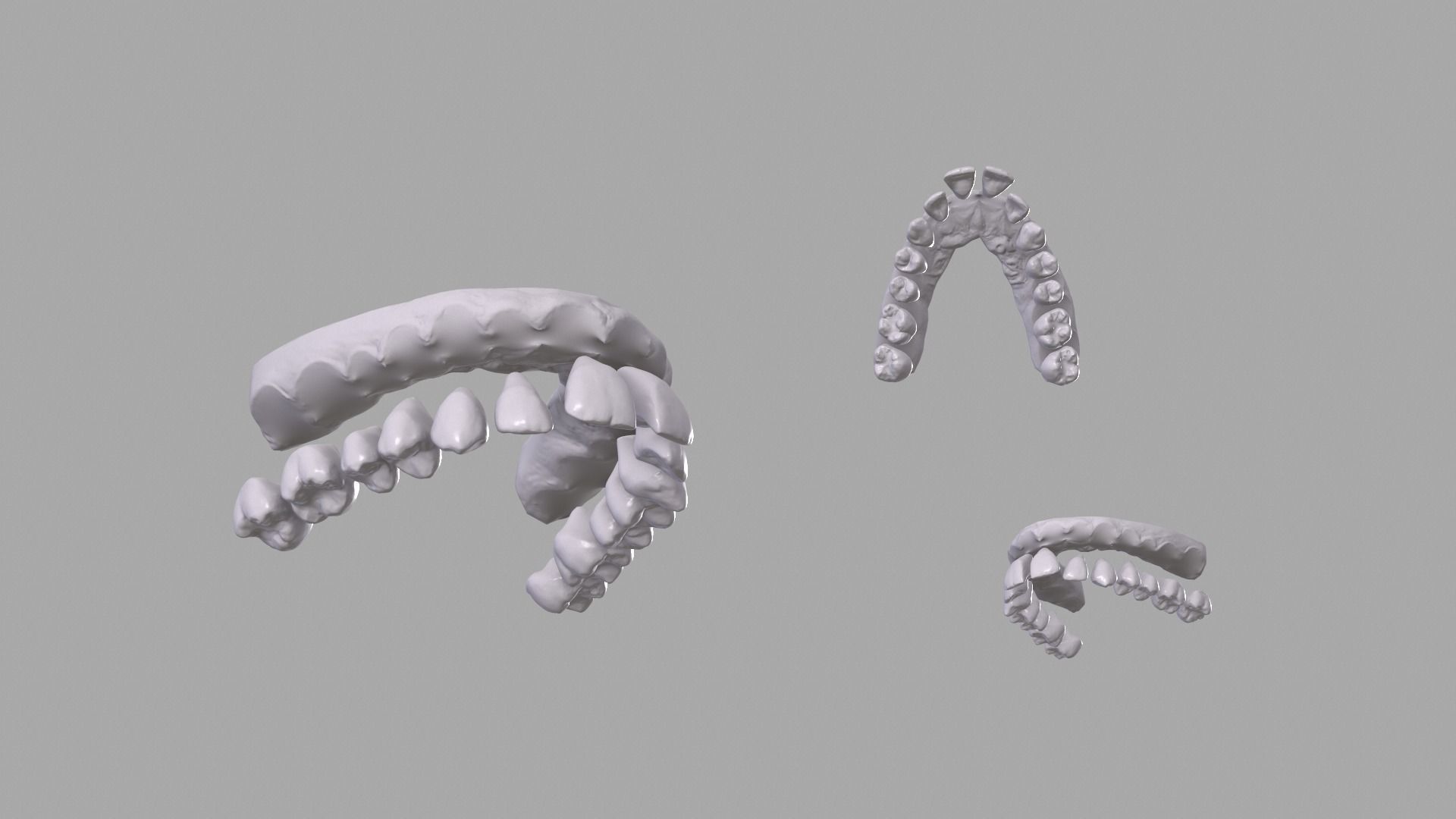 Dental upper jaw 3D scanned mouth with separated teeth  3D print model_5