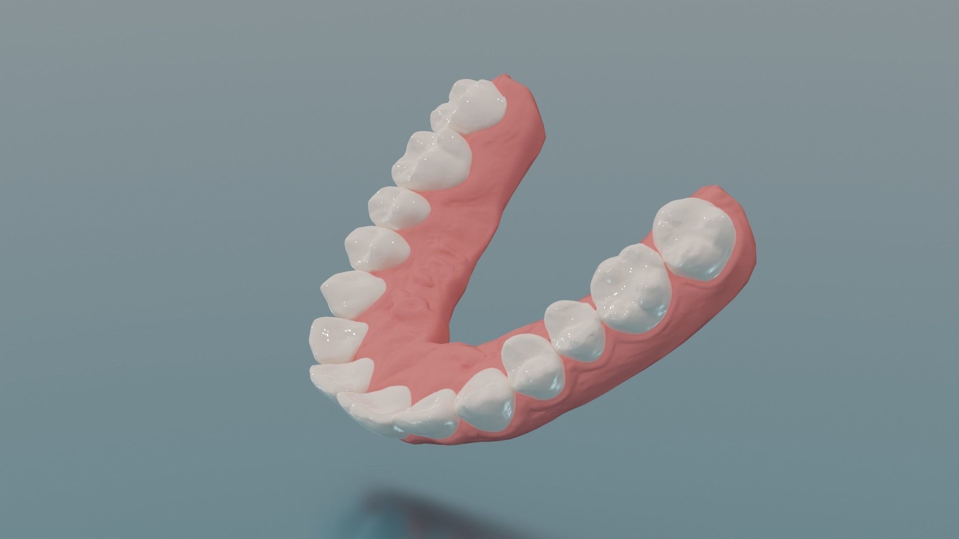 Dental upper jaw 3D scanned mouth with separated teeth  3D print model_4