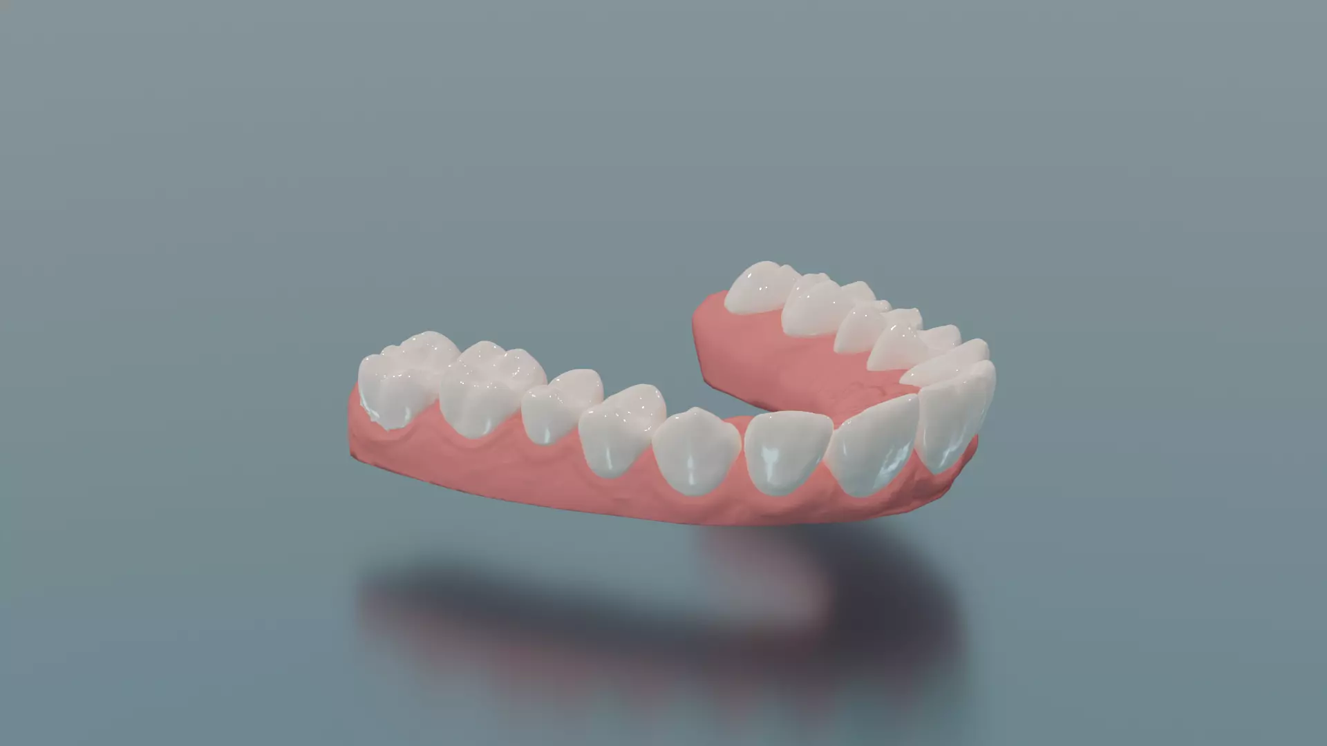 Dental upper jaw 3D scanned mouth with separated teeth  3D print model_0