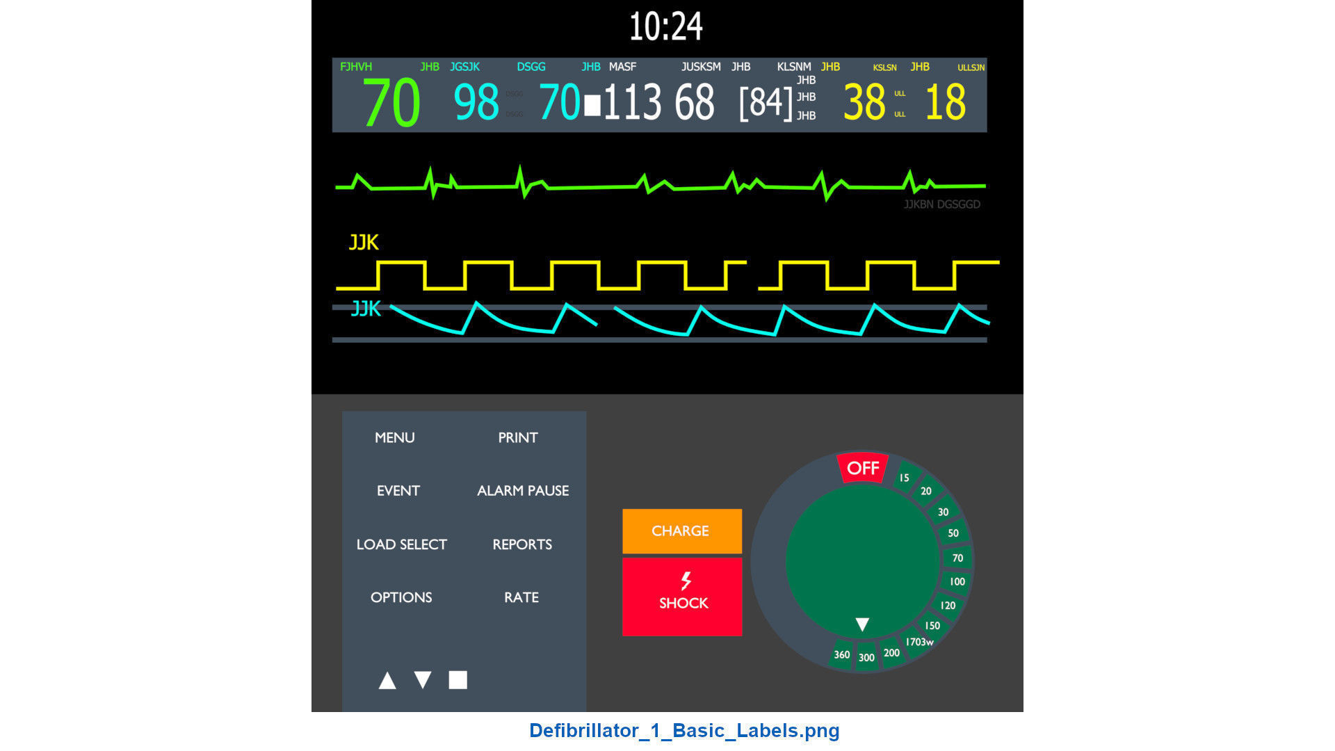 Defibrillator 1 Basic Low-poly 3D model_8