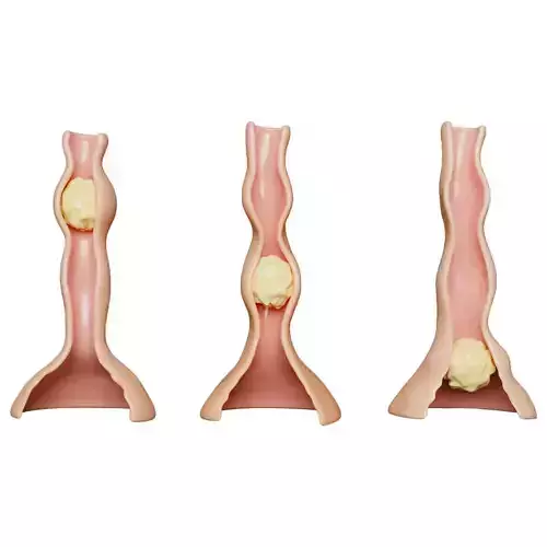 Peristalsis Function 3D model