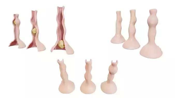 Peristalsis Function 3D model 2