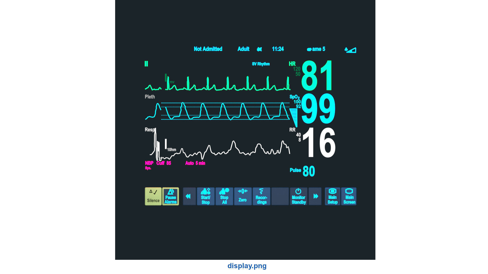 Electrocardiograph Machine 1 Basic Low-poly 3D model_8