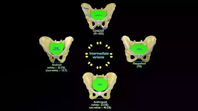 Pelvis types hip bone labelled detailed 3D model