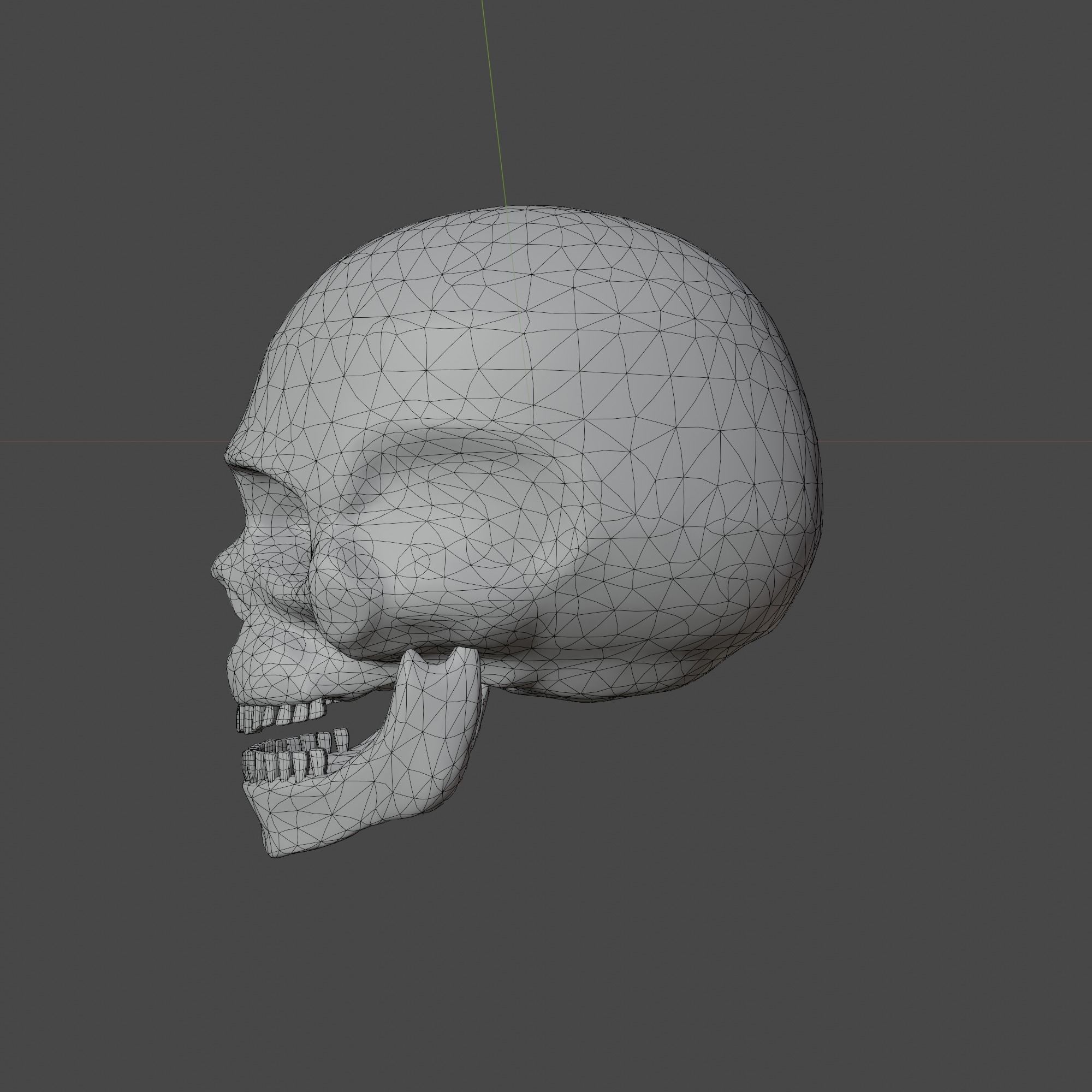 Normal and Decayed Skull - 3D Model 3D model_5