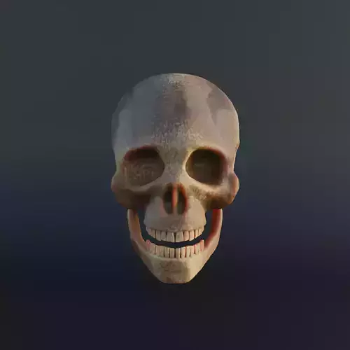 Normal and Decayed Skull - 3D Model