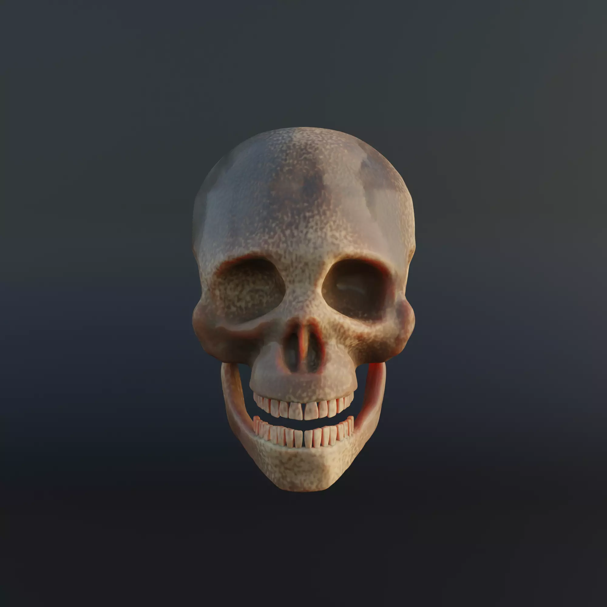Normal and Decayed Skull - 3D Model 3D model_0
