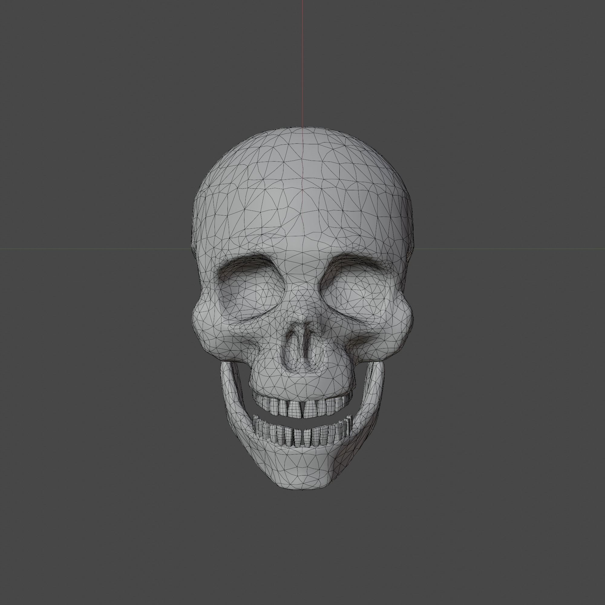 Normal and Decayed Skull - 3D Model 3D model_1