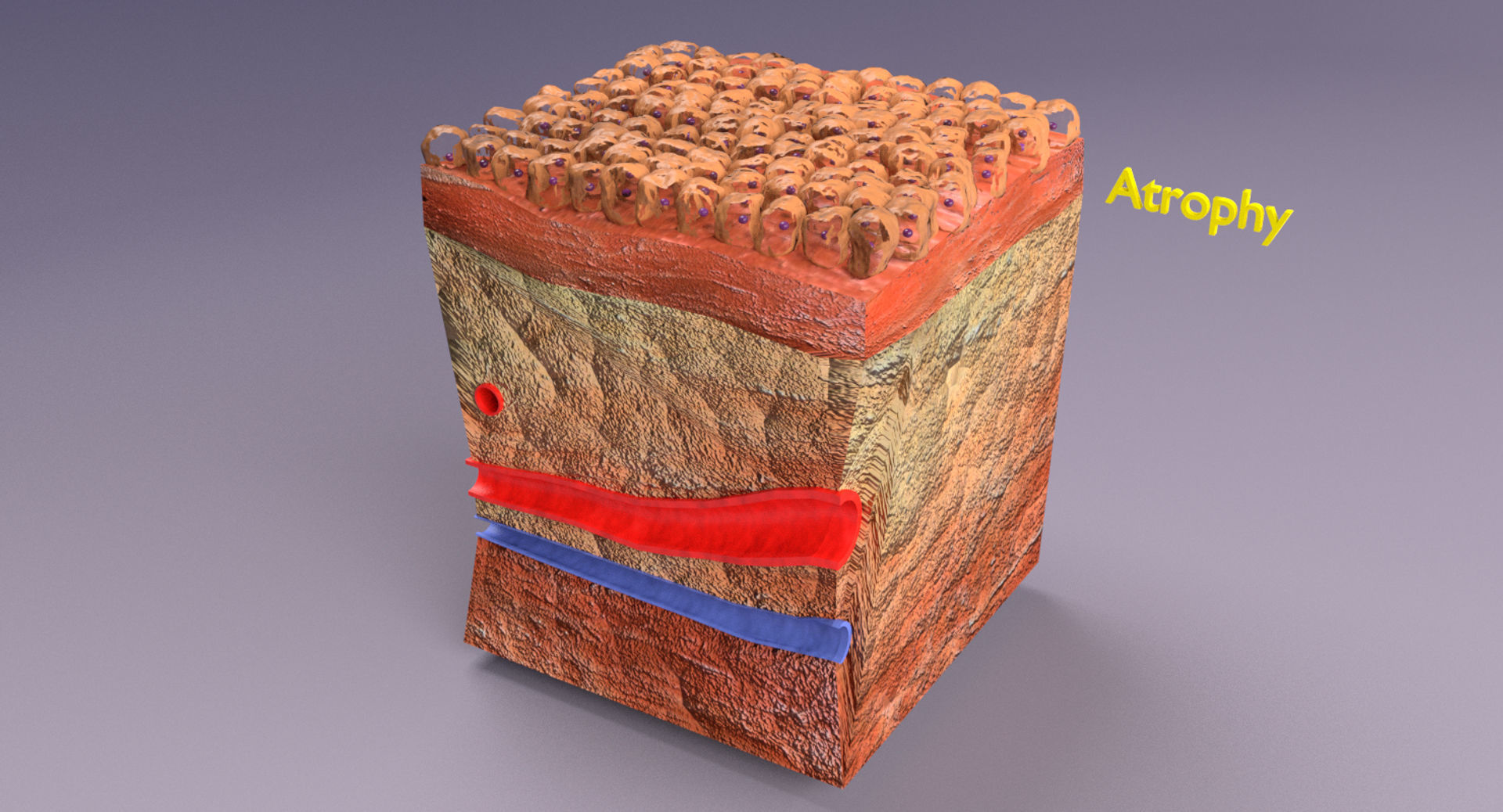 adaptation epithelial cell changes normal to cancer Low-poly 3D model_15