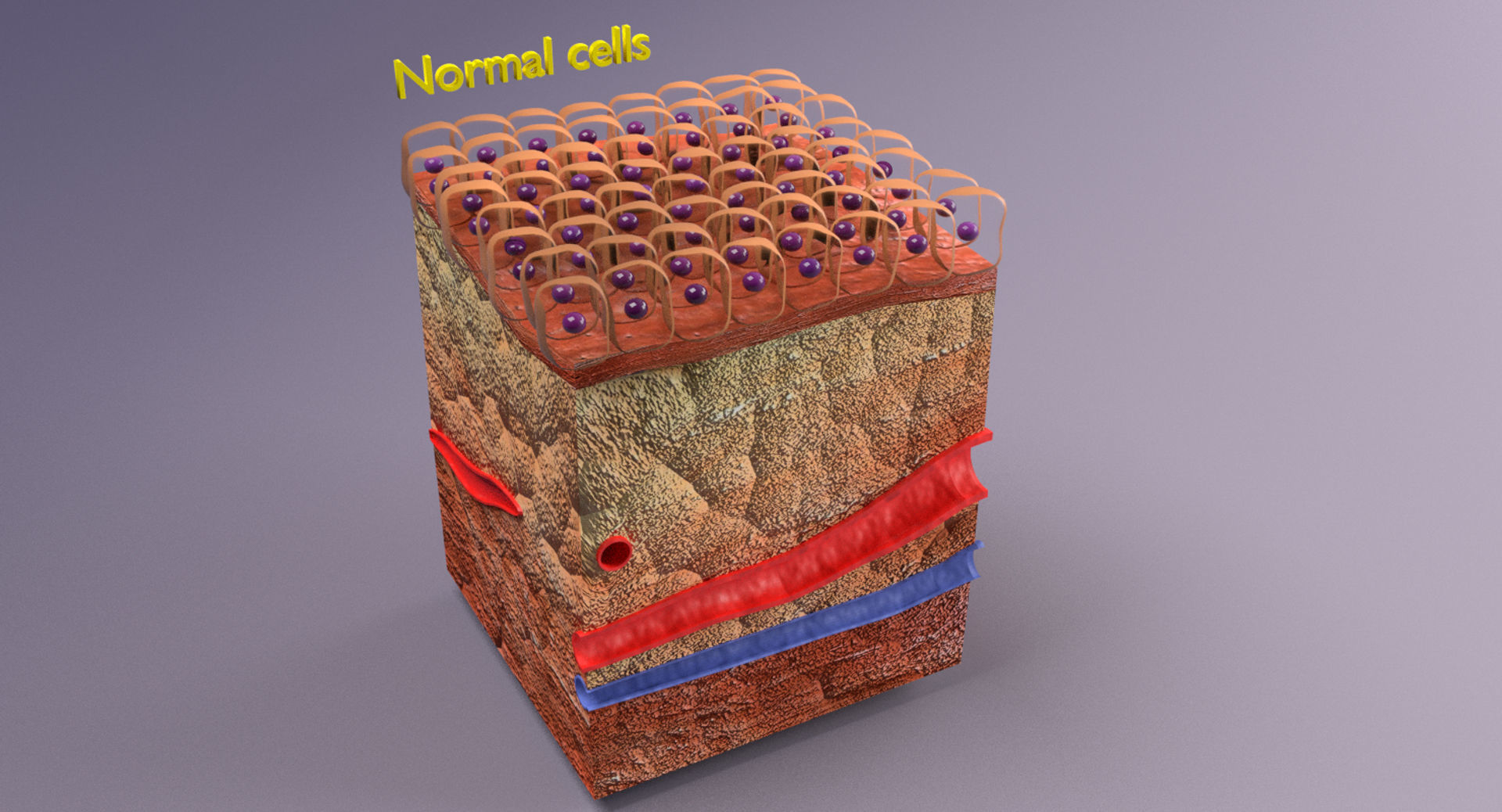 adaptation epithelial cell changes normal to cancer Low-poly 3D model_7