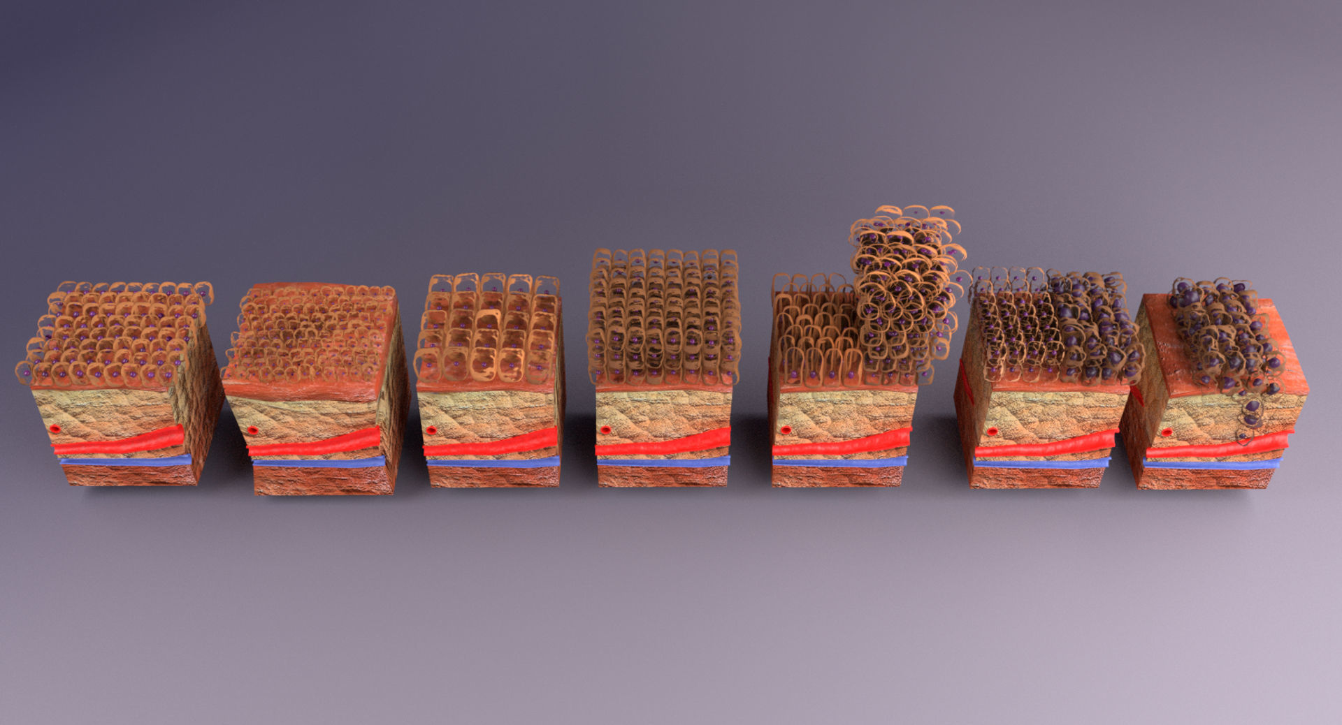 adaptation epithelial cell changes normal to cancer Low-poly 3D model_23