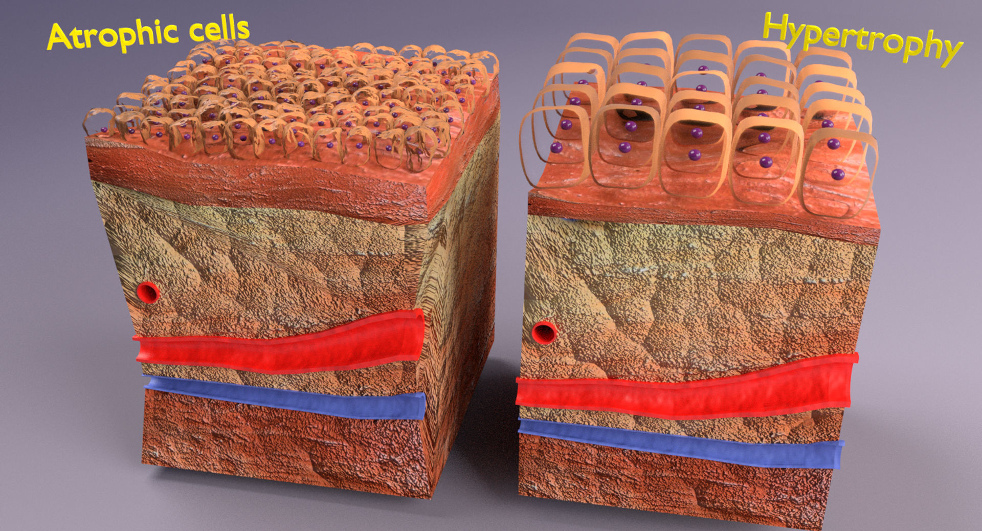 adaptation epithelial cell changes normal to cancer Low-poly 3D model_17