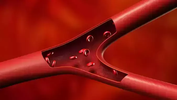 Clog Stream Bloodflow Layers Section Anatomy Artery Vein 