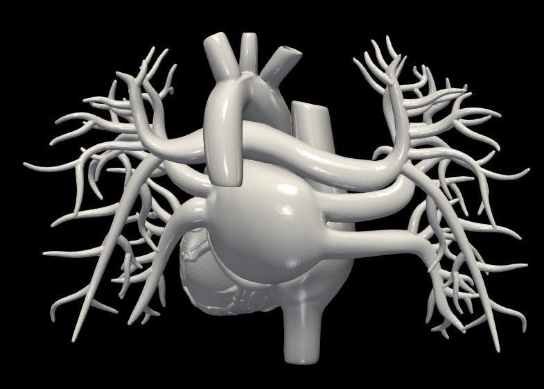 3d model of heart with vessels 3D model_3