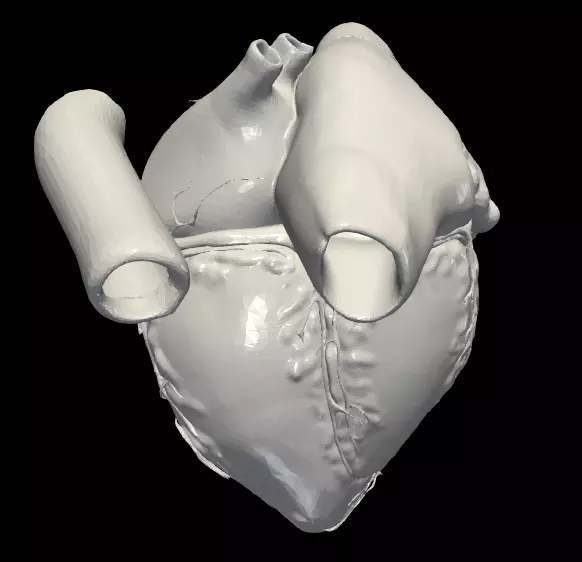 3d model of heart - apical 3 chamber plane 3D model