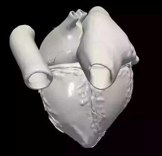 3d model of heart - apical 3 chamber plane