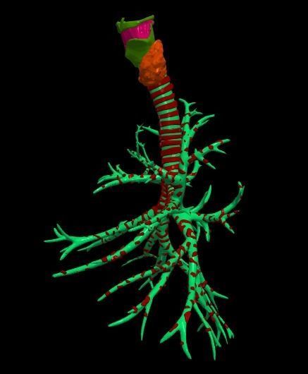 3d model of the lungs airways 3D model_9