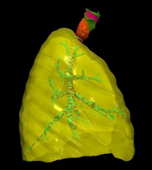 3d model of the lungs airways 3D model_5