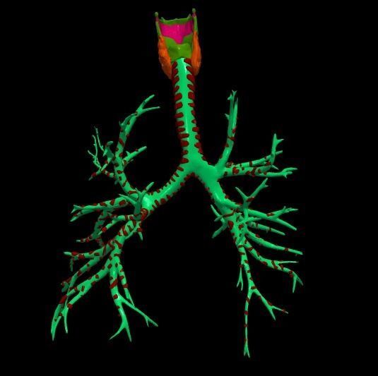 3d model of the lungs airways 3D model_6