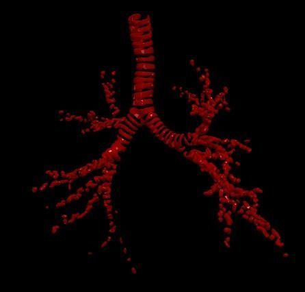 3d model of the lungs airways 3D model_2