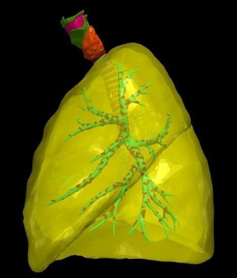 3d model of the lungs airways 3D model_3