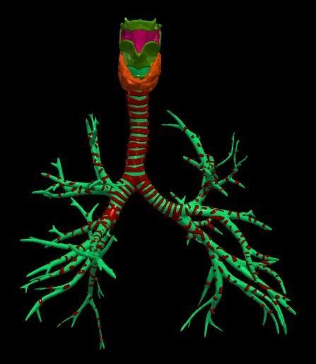 3d model of the lungs airways 3D model_8