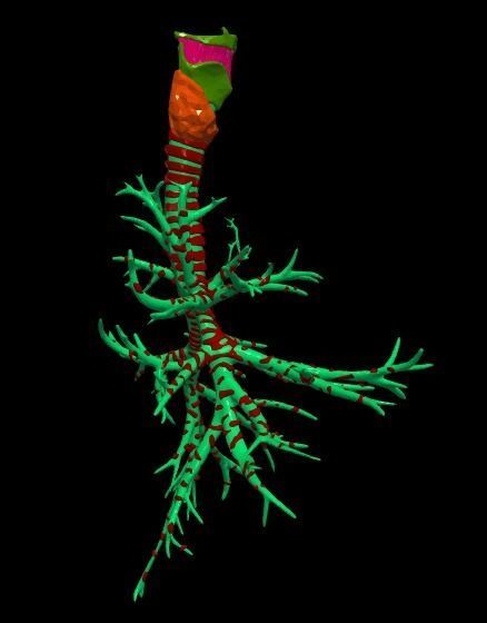 3d model of the lungs airways 3D model_7
