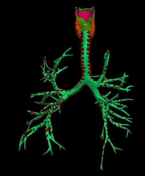 3d model of airways 3D model_3