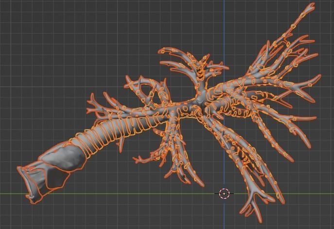 3d model of airways 3D model_11