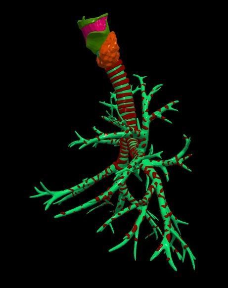 3d model of airways 3D model_2