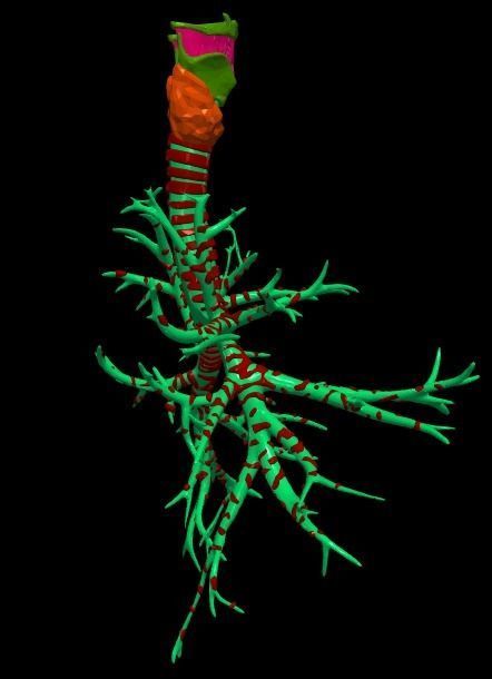 3d model of airways 3D model_4