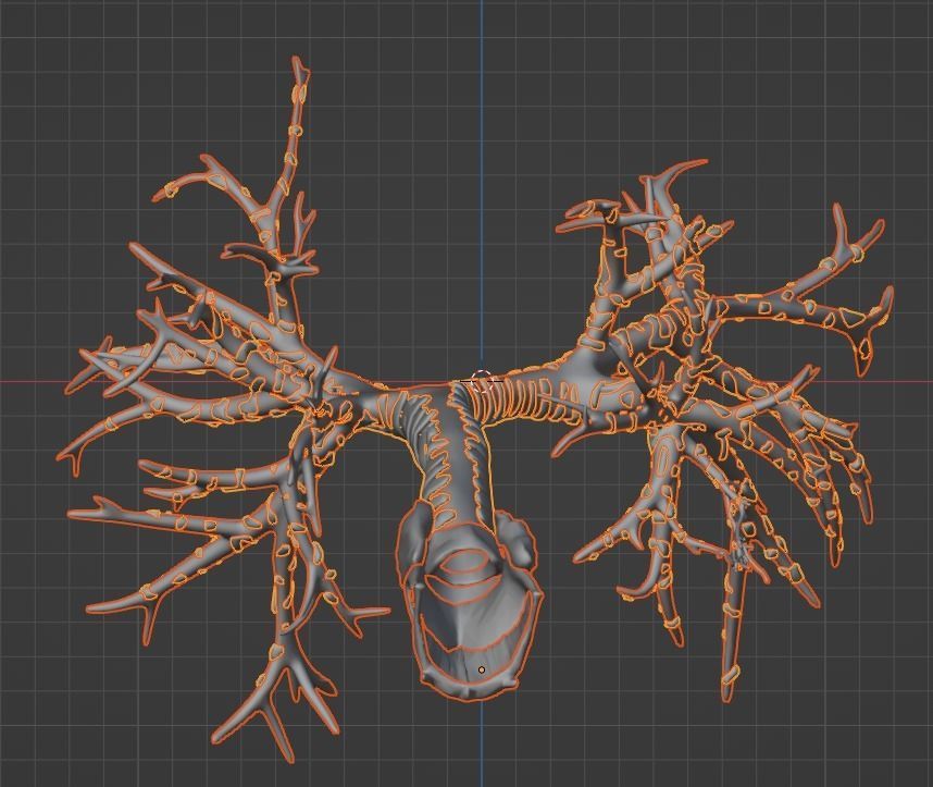 3d model of airways 3D model_14