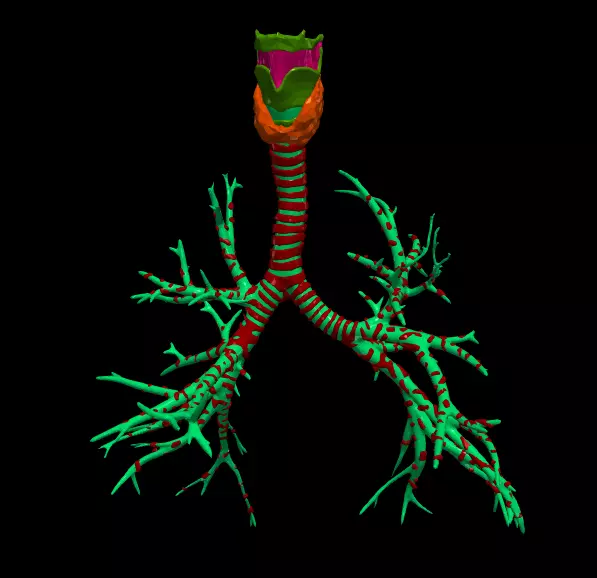 3d model of airways 3D model_0