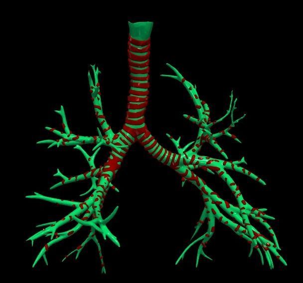 3d model of airways 3D model_7